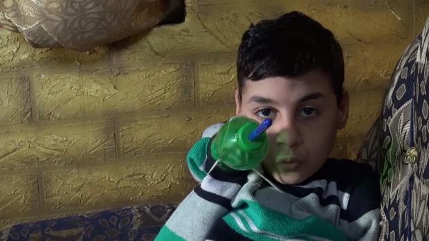 ziad-mohammed-egypt-bottle-arm.jpg