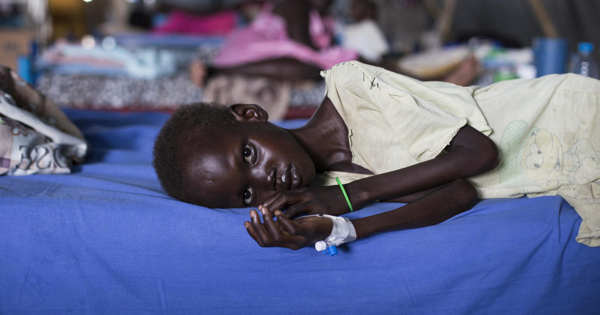 Millions Urgently Need Food In South Sudan S Famine CBS News   Famine Main 