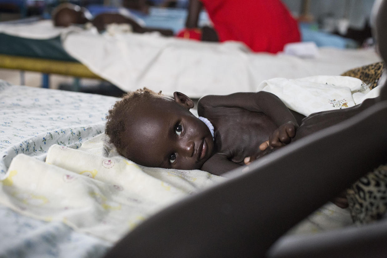 Famine Emergency Starving In South Sudan Pictures Cbs News