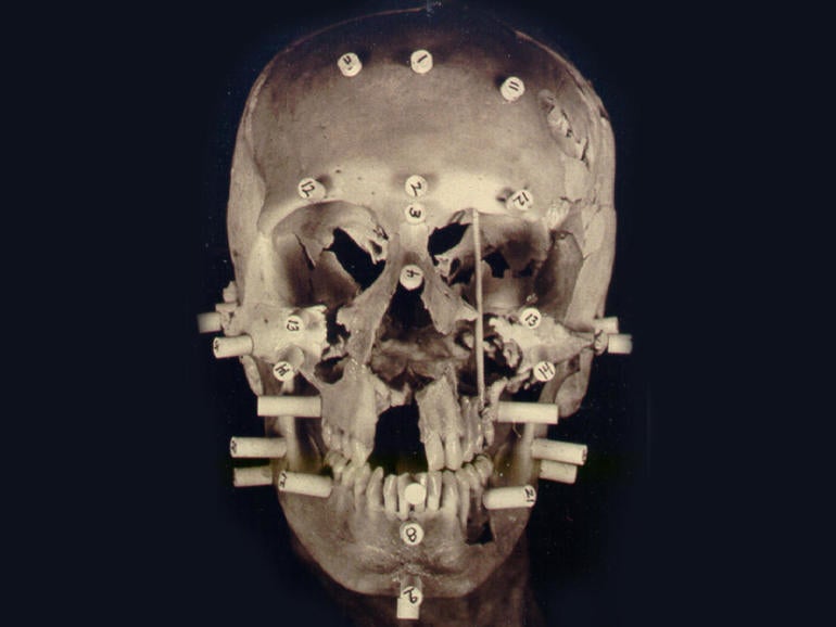 Annie Tahan skull reconstruction