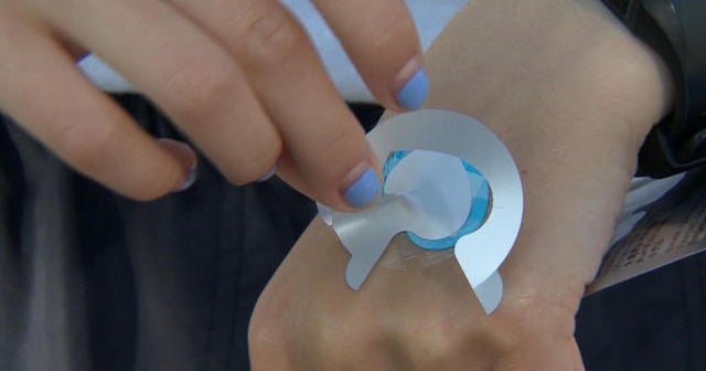 Wearable UV patch helps guard against sun damage, skin cancer CBS News