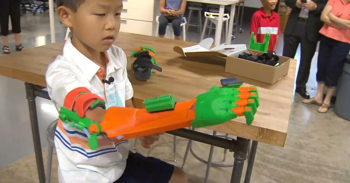 Boy highfives with new 3Dprinted prosthetic arm CBS News