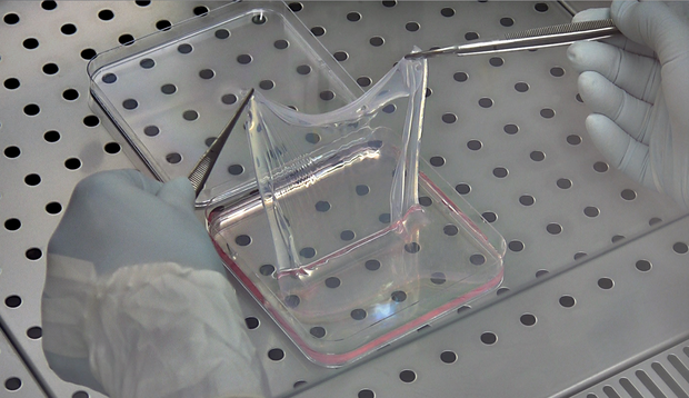 fibrin-cultured-epidermal-sheet-cmr-unimore.png