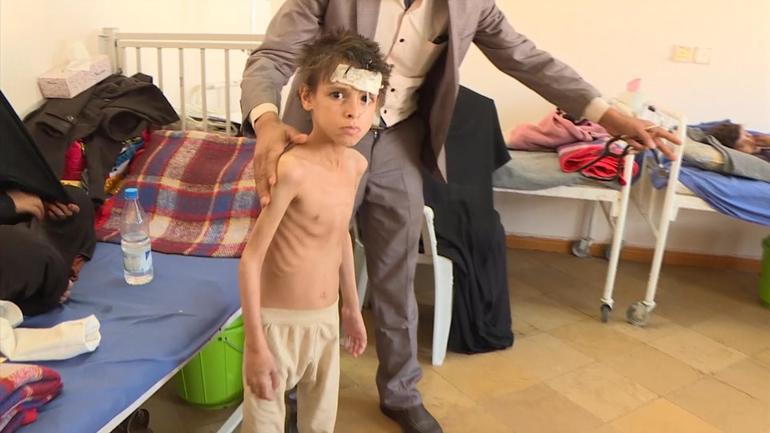 yemen-child-3.jpg 
