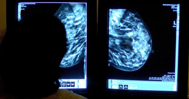 Study links birth control pills to breast cancer