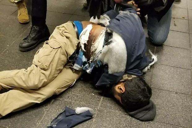 This photo confirmed by CBS News shows a suspect after his explosive device detonated in an underground passageway near the Port Authority Bus Terminal in New York City Dec. 11, 2017. 