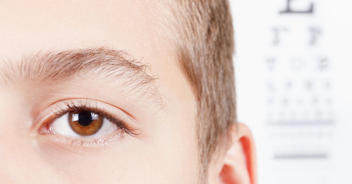 "Alarming" rise in eye injuries from BB, pellet and paintball guns in