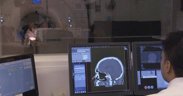 Brain Imaging Studies Seek Signs Of >> Scientists Seek Veterans To Help Treat Cte Cbs News Brain Imaging Studies Seek Signs Of >> Scientists Seek Veterans To Help Treat Cte Cbs News