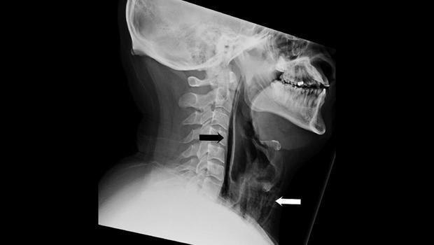 xray.jpg