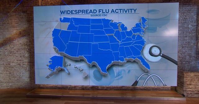 Deadly flu season has likely peaked, CDC says