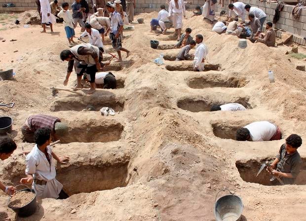 YEMEN-CONFLICT-CHILDREN-SAUDI