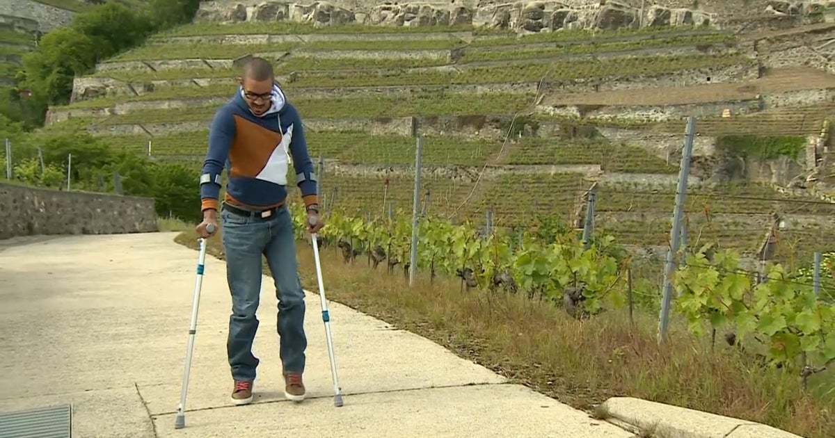 Paralyzed patients walk again with help of spinal implant CBS News