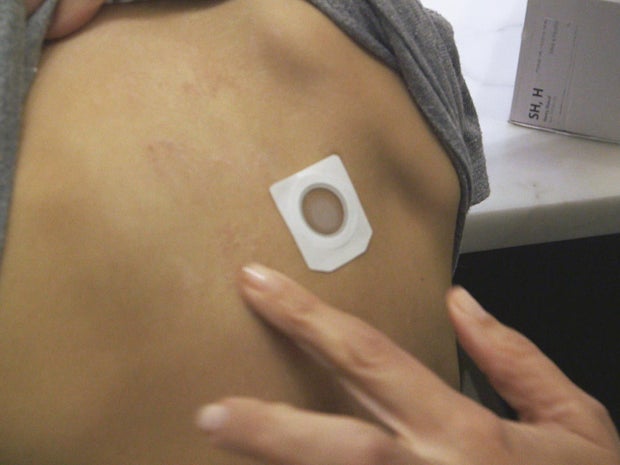 peanut-skin-patch-promo.jpg