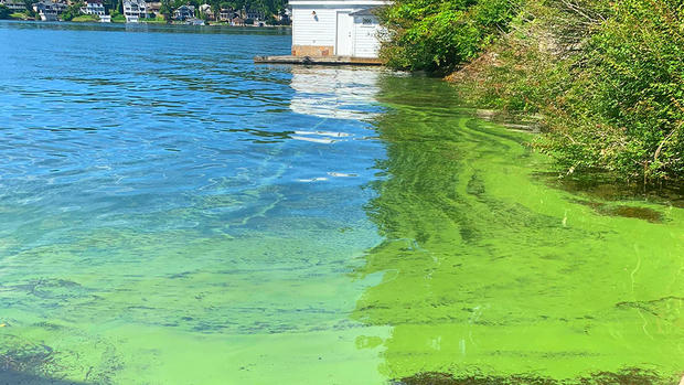 Algae Bloom On Lake Hopatcong 