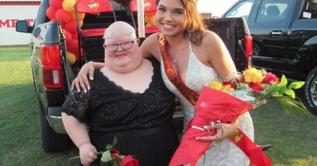 Homecoming Queen Porn - Homecoming queen with Down syndrome: Texas teen shares crown ...