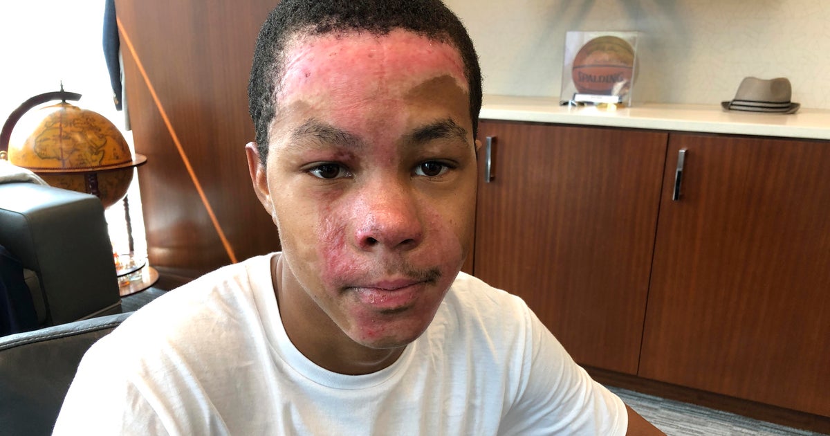 Chemistry teacher "froze in pure shock" after botched experiment injured teen at Redan High School outside Atlanta, report says - CBS News