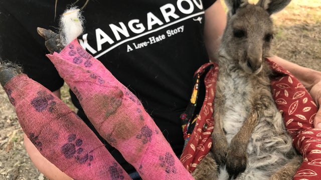 WIRES volunteer and carer Tracy Dodd holds a kangaroo with burnt feet pads after being rescued from bushfires in Australia's Blue Mountains area 