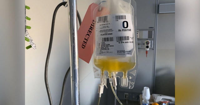Using plasma transfusions to treat COVID19 CBS News
