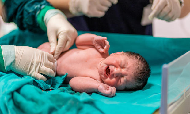 doctor cutting baby's umbilical cord 