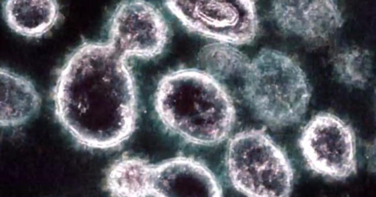 Experts suggest improving ventilation may reduce coronavirus spread - CBS News thumbnail
