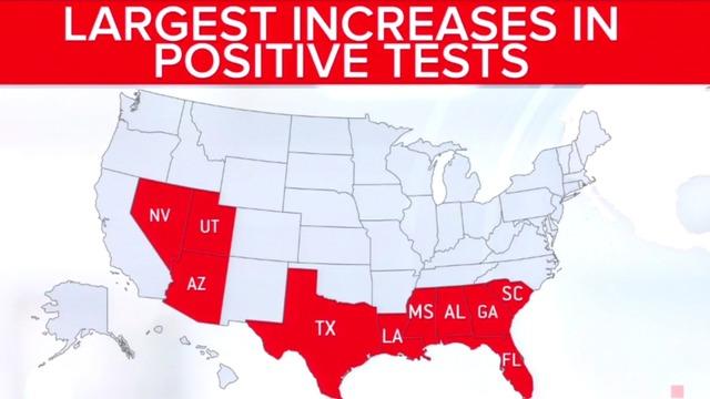 Coronavirus Cases In Florida Continue To Climb As More Young People Test Positive Cbs News Coronavirus Cases In Florida Continue To Climb As More Young People Test Positive Cbs News