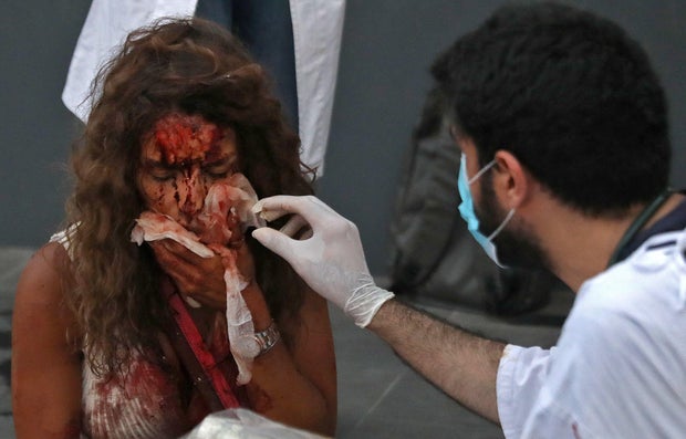 LEBANON-BLAST