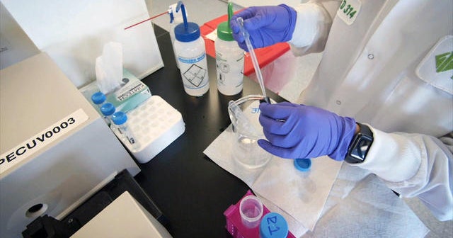 The COVID19 treatments showing the most promise CBS News