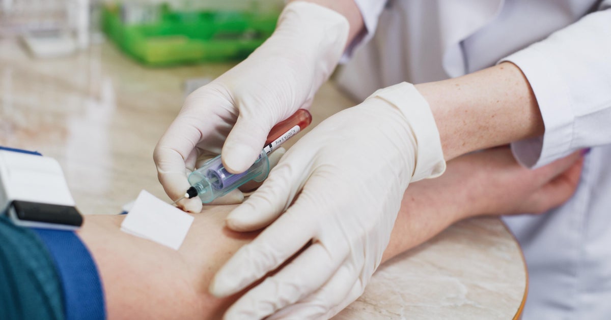 U.K. eases restrictions on blood donations from gay and bisexual men