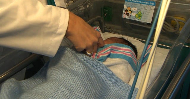 C-sections linked to obesity risk