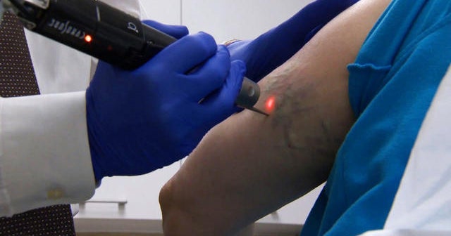 Tattoo removal faster with new laser treatment