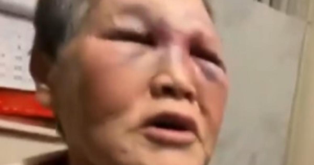 Elderly Asian woman attacked in San Francisco fights back, sends alleged attacker to hospital