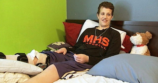 Teen battles aggressive flesh-eating bacteria