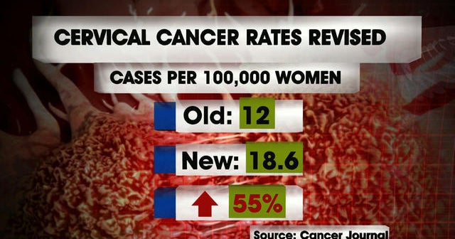 Cervical cancer rates show dramatic increase in U.S.