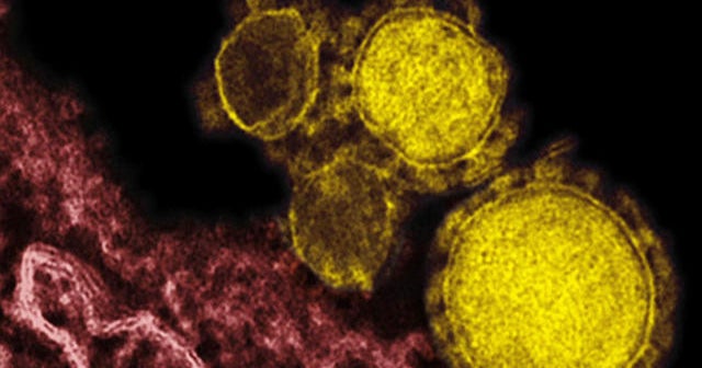 Just how dangerous is MERS?