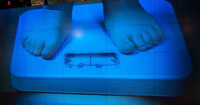 Childhood obesity linked to reduced sleep, study says