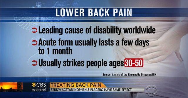Tylenol not more effective than placebo for back pain, study finds