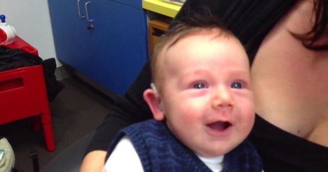 Watch: 7-week-old baby gets a hearing aid