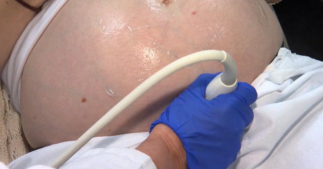 Vitamin D could affect female fertility