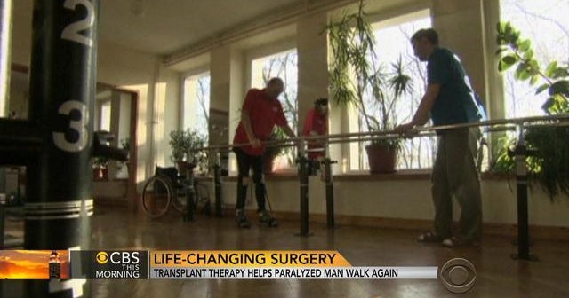 Transplant therapy helps paralyzed man walk again