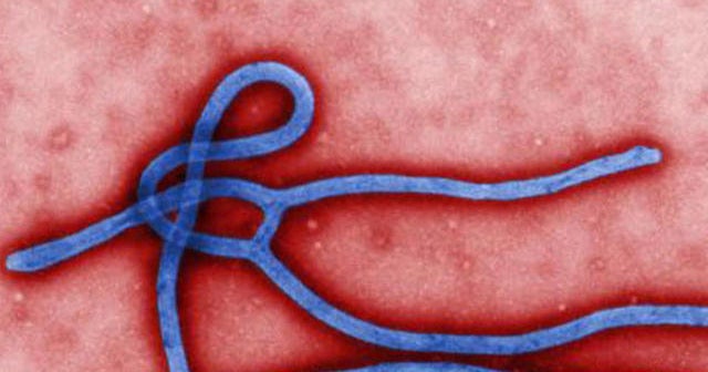 Dallas Ebola patient treated with experimental drug