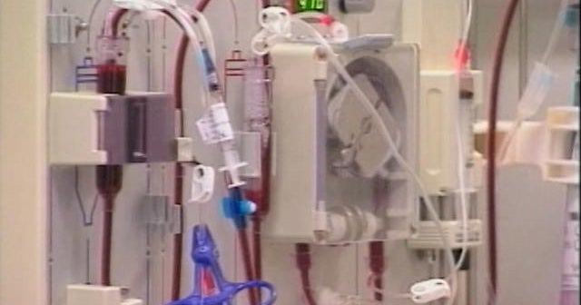 New advice for dialysis patients