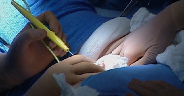 Breast cancer patients shifting treatment choices