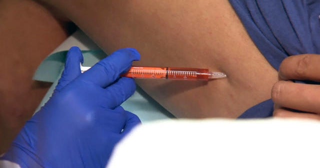 FDA fast-tracking unbelievable eczema drug