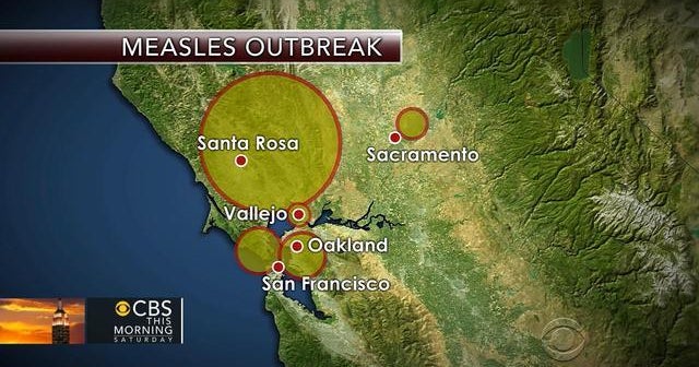 Measles outbreak: More than two dozen children quarantined