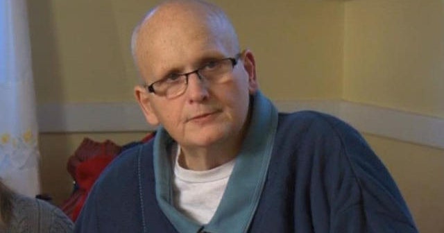 Man who lost 650 pounds will be different person after surgery