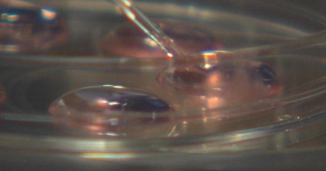 Judge orders frozen embryos be destroyed after divorce