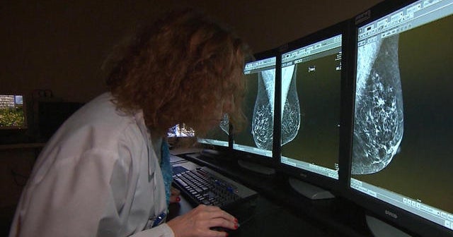 New debate over breast cancer treatment