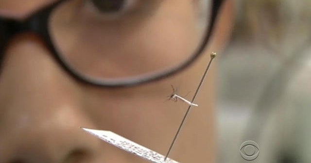 CDC confirms Zika link to microcephaly