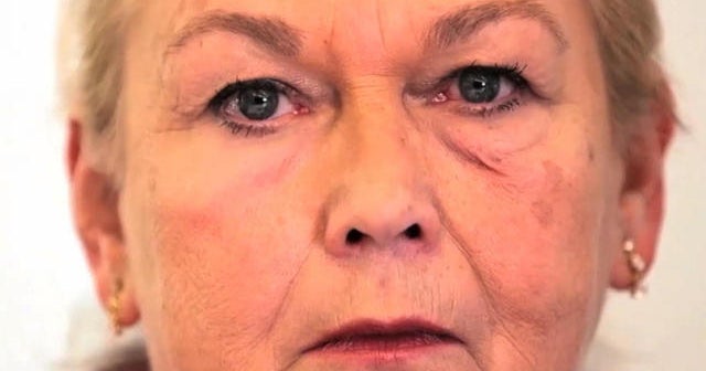 Second skin gel temporarily tightens wrinkles