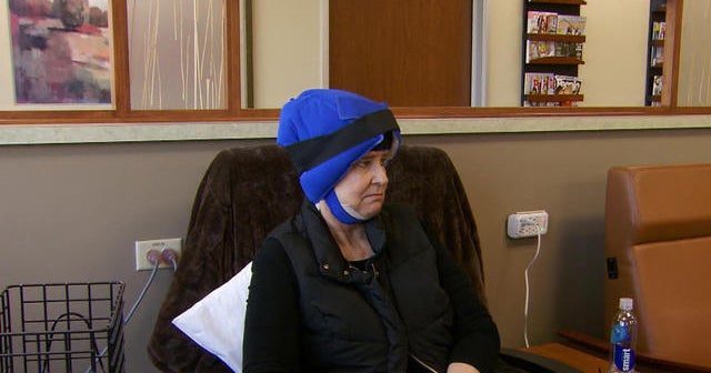 Cold caps help breast cancer patients keep hair